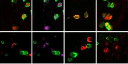 תאי גזע עובריים המתפתחים לתאי מין, מהם נמחק הגן המקודד לאנזים Utx, מסומנים בחלבון פלואורסצנטי ירוק זוהר. בכל אחת מהעמודות מסומן (באדום, בסגול או בכתום) גן חיוני להישרדות ולהתפתחות תאי המין. השוואה של היום העשירי להתפתחות התאים (בשורה העליונה) עם יום 12 (בשורה התחתונה) מראה כי הביטוי של ארבעת הגנים החיוניים מופסק. בעקבות כך תאי הגזע אינם מתפתחים לתאי זרע או ביצית, אלא מתים
